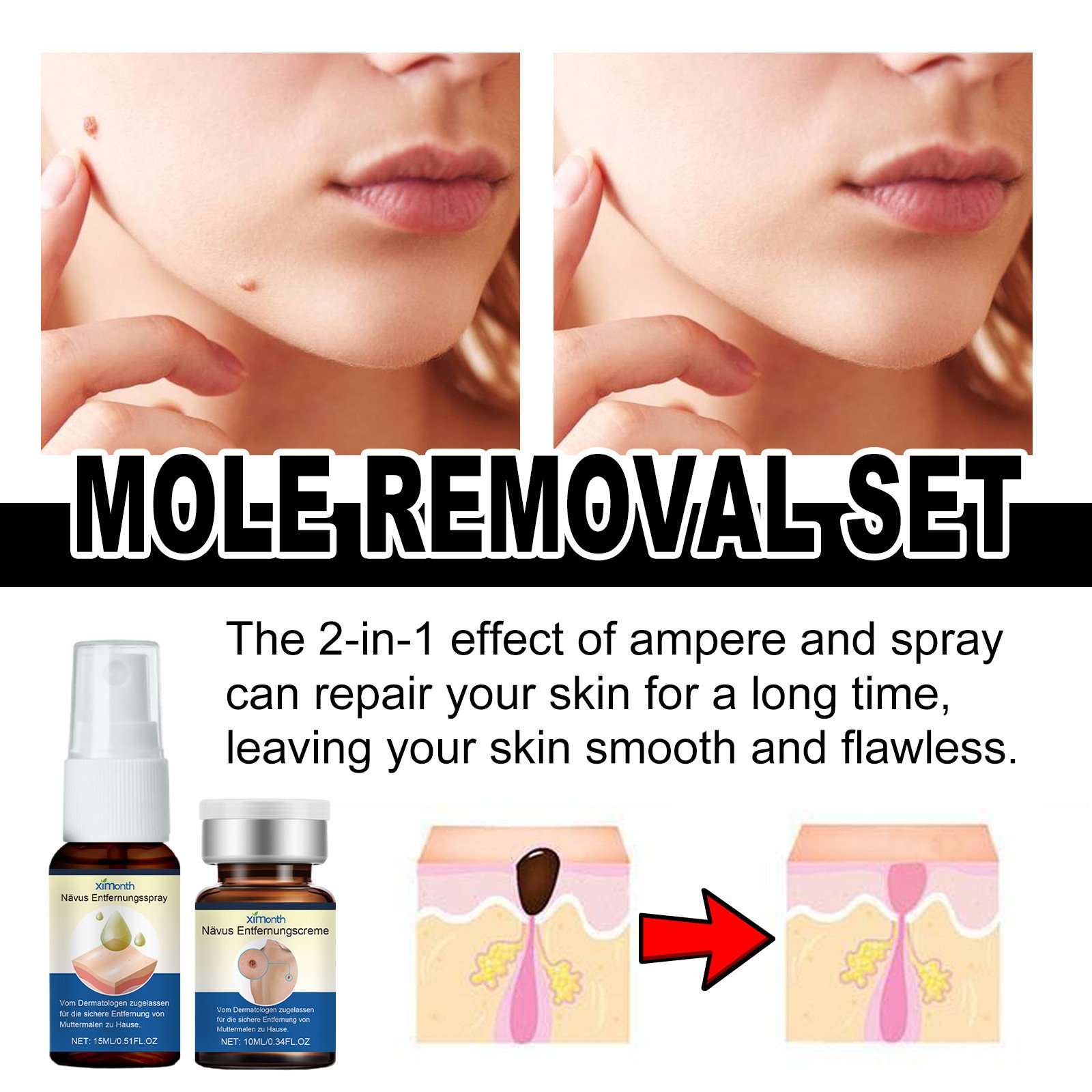 Skin Mole Care Suit Body Cleaning - Image 2